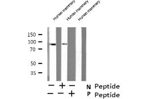 Western blot analysis of ATRIP (Phospho-Ser224) expression in Human mammary cell lysate (ATRIP Antikörper  (pSer224))