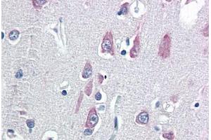 Human Brain, Cortex (formalin-fixed, paraffin-embedded) stained with VPS25 antibody ABIN337136 at 5 ug/ml followed by biotinylated goat anti-rabbit IgG secondary antibody ABIN481713, alkaline phosphatase-streptavidin and chromogen. (VPS25 Antikörper  (N-Term))
