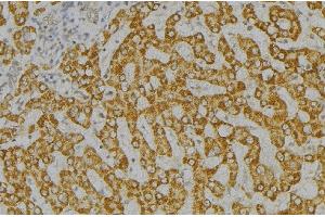ABIN6276546 at 1/100 staining Mouse liver tissue by IHC-P. (SH2D1A Antikörper  (Internal Region))