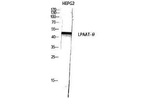 Western Blotting (WB) image for anti-1-Acylglycerol-3-Phosphate O-Acyltransferase 9 (AGPAT9) (C-Term) antibody (ABIN3175864) (AGPAT9 Antikörper  (C-Term))