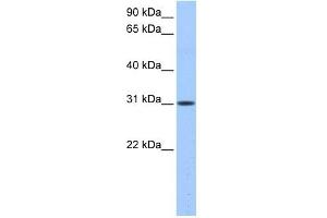 HUS1B antibody used at 0. (HUS1B Antikörper)