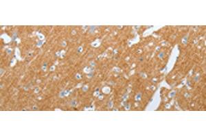 Immunohistochemistry (Paraffin-embedded Sections) (IHC (p)) image for anti-Solute Carrier Family 17 (Vesicular Glutamate Transporter), Member 7 (SLC17A7) antibody (ABIN7254217)