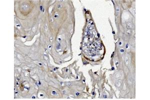 IHC analysis of GSDMD using anti-GSDMD antibody (ABIN7599432). (GSDMD Antikörper  (AA 1-484))