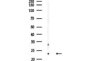 Western blot analysis of lysates from HepG2 cells(heat-shock,45 min treatment), using BOK Antibody at 1/1000 dilution.