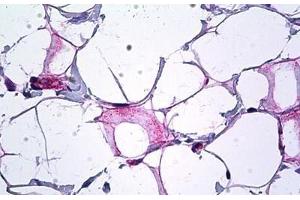 Human Breast, Collagen: Formalin-Fixed, Paraffin-Embedded (FFPE) (COL18A1 Antikörper  (AA 801-850))