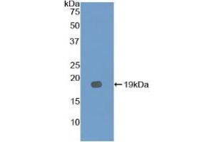 Western blot analysis of recombinant Mouse IL12Rb2. (IL12RB2 Antikörper  (AA 285-441))