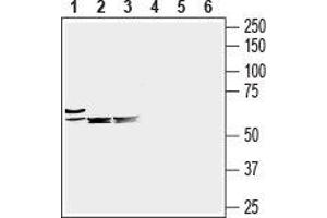 Western blot analysis of mouse heart (lanes 1 and 4), mouse brain (lanes 2 and 5) and rat brain (lanes 3 and 6) lysates: - 1-3. (SLC6A8 Antikörper  (C-Term, Extracellular))