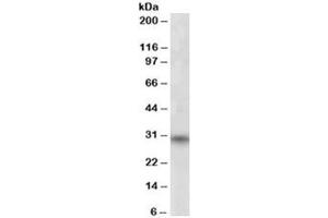 Western blot testing of human skeletal muscle lysate with FHL3 antibody at 1ug/ml. (FHL3 Antikörper)