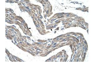 GPR161 antibody was used for immunohistochemistry at a concentration of 4-8 ug/ml to stain Skeletal muscle cells (arrows) in Human Muscle. (GPR161 Antikörper  (C-Term))