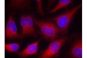 Immunofluorescence staining of methanol-fixed Hela cells using VASP(Ab-157) Antibody.