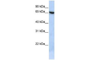 WB Suggested Anti-C19orf6 Antibody Titration: 0. (Membralin Antikörper  (N-Term))