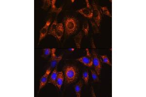 Immunofluorescence analysis of NIH/3T3 cells using UB Rabbit pAb (ABIN7271120) at dilution of 1:100. (UBAC2 Antikörper  (AA 220-310))
