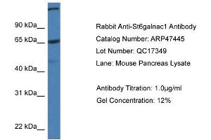 Western Blotting (WB) image for anti-ST6 (Alpha-N-Acetyl-Neuraminyl-2,3-beta-Galactosyl-1,3)-N-Acetylgalactosaminide alpha-2,6-Sialyltransferase 1 (ST6GALNAC1) (C-Term) antibody (ABIN785365) (ST6GALNAC1 Antikörper  (C-Term))