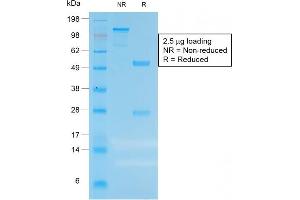 SDS-PAGE Analysis of Purified CEA Rabbit Recombinant Monoclonal Antibody (C66/1983R). (Rekombinanter CEACAM5 Antikörper)