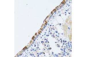 Immunohistochemistry of paraffin-embedded rat lung using ST3GAL3 antibody (ABIN2560155) at dilution of 1:100 (40x lens). (ST3GAL3 Antikörper)