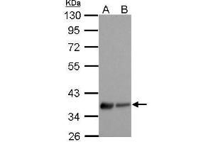 WB Image EDG7 antibody [N3C2], Internal detects LPAR3 protein by Western blot analysis.