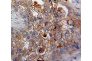 IHC-P analysis of Lung tissue, with DAB staining. (DDR2 Antikörper  (AA 578-817))