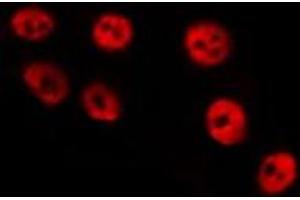 ABIN6275313 staining HepG2 by IF/ICC. (PPP1R8 Antikörper  (Internal Region))