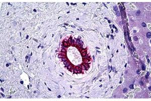 Human Liver, Bile Duct: Formalin-Fixed, Paraffin-Embedded (FFPE) (KRT8 Antikörper)