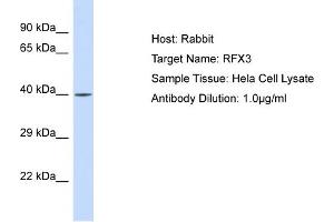 Host: Rabbit Target Name: RFX3 Sample Type: Hela Whole Cell lysates Antibody Dilution: 1. (RFX3 Antikörper  (N-Term))
