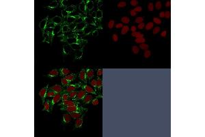 Confocal Immunofluorescence image of HeLa cells stained with Clathrin, HC Monoclonal Antibody (CHC/1432) followed by Goat anti-Mouse CF488 (green). (Clathrin Heavy Chain (CLTC) Antikörper)