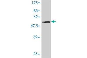 Western Blotting (WB) image for anti-Solute Carrier Family 27 (Fatty Acid Transporter), Member 4 (SLC27A4) (AA 1-237) antibody (ABIN564768)