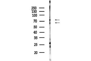 Western blot analysis of lysates from HepG2 cells(starvation,24h treatment), using PLAT Antibody at 1/1000 dilution.