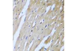 Immunohistochemistry (Paraffin-embedded Sections) (IHC (p)) image for anti-rho-Associated, Coiled-Coil Containing Protein Kinase 1 (ROCK1) (AA 400-660) antibody (ABIN6147066)