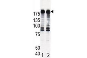 Western blot analysis of EGF Receptor antibody and HeLa cell lysate, either induced (Lane 1) or noninduced with EGF (2). (EGFR Antikörper  (AA 1048-1077))