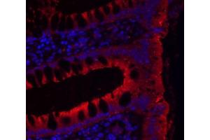 Immunohistochemistry (IHC) image for anti-Junctional Adhesion Molecule 2 (JAM2) antibody (ABIN2855842)
