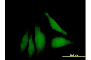Immunofluorescence of purified MaxPab antibody to WDSUB1 on HeLa cell. (WDSUB1 Antikörper  (AA 1-384))