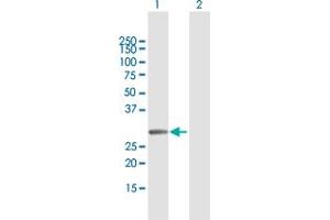 Western Blot analysis of MMS19 expression in transfected 293T cell line by MMS19 MaxPab polyclonal antibody. (MMS19 Antikörper  (AA 1-293))
