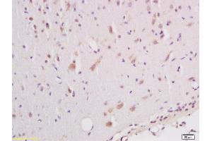 Formalin-fixed and paraffin embedded rat brain labeled with Anti phospho-B-Raf (Ser602) Polyclonal Antibody, Unconjugated (ABIN745373) at 1:200 followed by conjugation to the secondary antibody and DAB staining (SNRPE Antikörper  (pSer602))