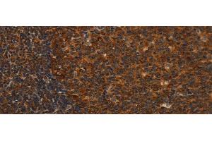 Immunohistochemistry of paraffin-embedded Human tonsil tissue using MIP Polyclonal Antibody at dilution 1:40 (Mip Antikörper)