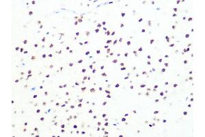 Immunohistochemistry of paraffin-embedded rat brain using DKC1 Rabbit mAb (ABIN7266869) at dilution of 1:100 (40x lens). (DKC1 Antikörper)