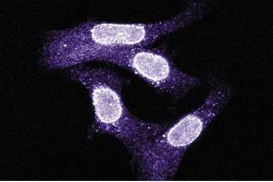 Immunofluorescent staining on SK-BR3 cells. (XPO1 Antikörper  (AA 2-122))