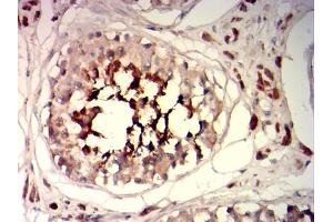 Immunohistochemical analysis of paraffin-embedded testis tissues using SP17 mouse mAb with DAB staining. (SPA17 Antikörper  (AA 1-152))