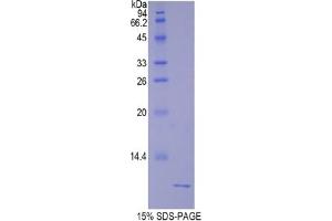 SDS-PAGE analysis of Rat Urocortin 2 Protein. (Urocortin 2 Protein (UCN2))