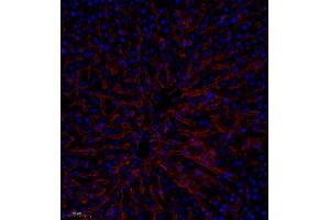Immunofluorescence analysis of paraffin embedded human liver using CD35 (ABIN7073563) at dilution of 1: 650 (CD35 Antikörper)