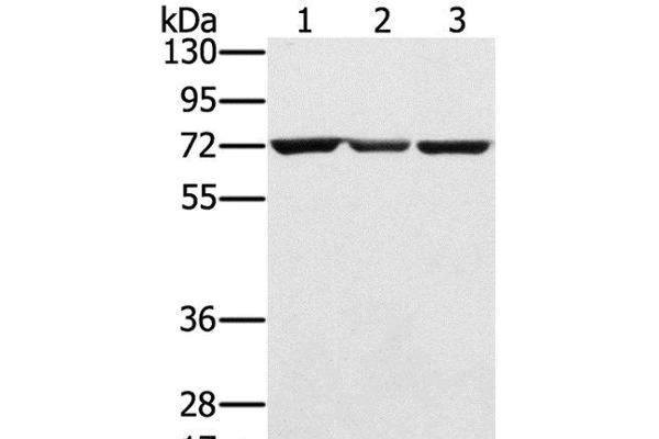 slc25a13 anticorps