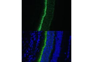 Immunofluorescence analysis of mouse eye using GNGT1 Polyclonal Antibody (ABIN7267288) at dilution of 1:100 (40x lens).