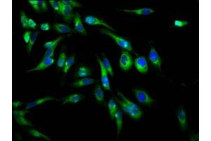 Immunofluorescence staining of Hela cells with ABIN7163704 at 1:66, counter-stained with DAPI. (PLXNB1 Antikörper  (AA 664-837))