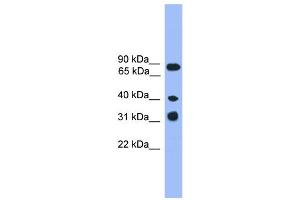 WB Suggested Anti-LAX1  Antibody Titration: 0.