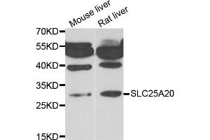 Western blot analysis of extracts of various cell lines, using SLC25A20 antibody. (SLC25A20 Antikörper)