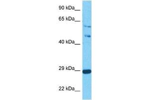 Host:  Rabbit  Target Name:  SPIC  Sample Tissue:  Human Jurkat Whole Cell  Antibody Dilution:  1ug/ml (SPIC Antikörper  (C-Term))
