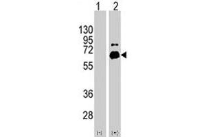 Western blot analysis of RPS6KB1 (arrow) using RPS6KB1 polyclonal antibody . (RPS6KB1 Antikörper  (Ser424))