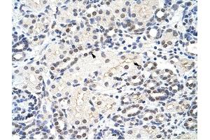 MRM1 antibody was used for immunohistochemistry at a concentration of 4-8 ug/ml to stain Epithelial cells of renal tubule (arrows) in Human Kidney. (MRM1 Antikörper)