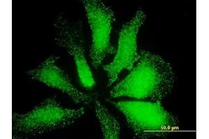 Immunofluorescence of monoclonal antibody to LMO3 on HeLa cell. (LMO3 Antikörper  (AA 91-146))