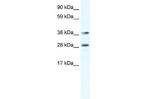MEF2B antibody (20R-1125) used at 0.