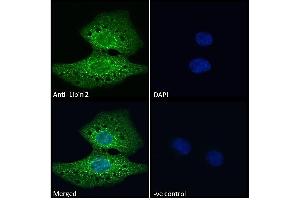ABIN185361 Immunofluorescence analysis of paraformaldehyde fixed U2OS cells, permeabilized with 0. (Lipin 2 Antikörper  (C-Term))